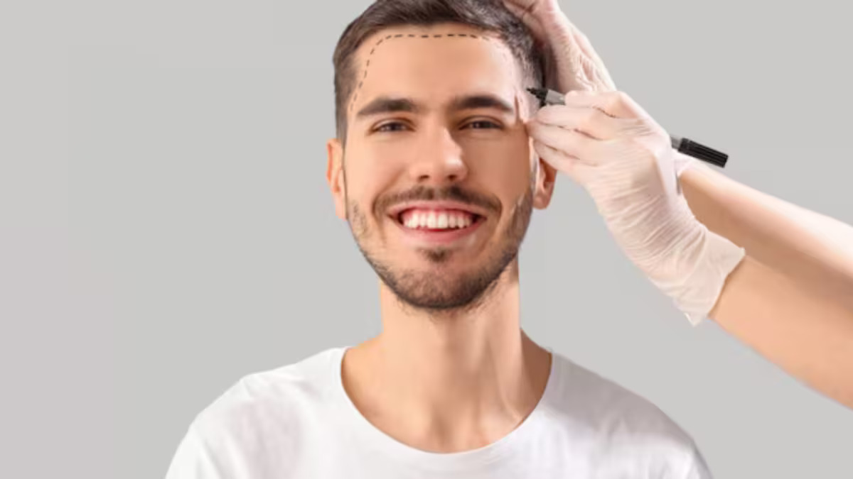 Hair Transplant in Armenia: Everything International Patients Need to Know