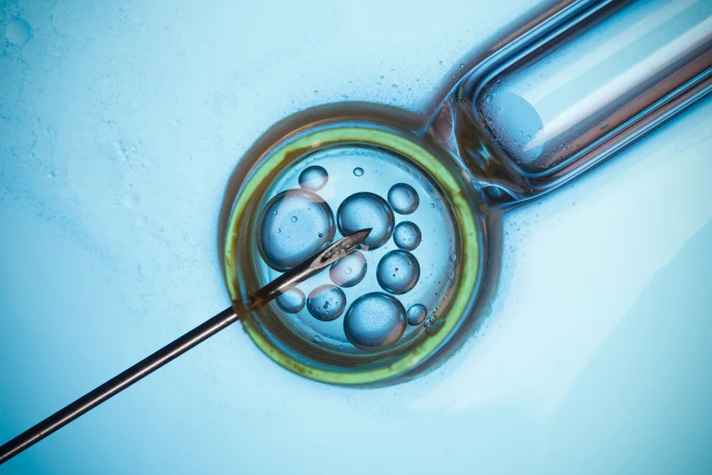 IVF in Armenia: Why International Patients Choose Armenia for Fertility Treatment