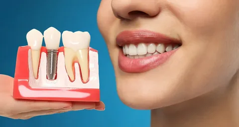 Dental Implants in Armenia: A Complete Guide for International Patients