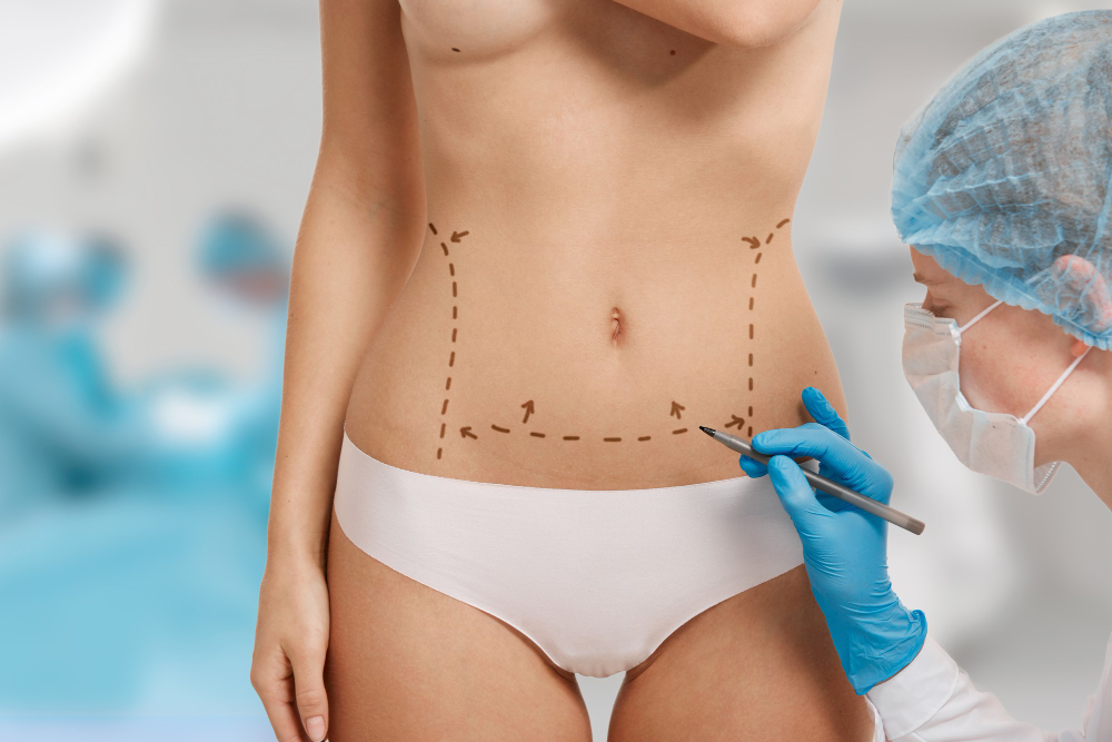 Tummy Tuck in Armenia: A Guide for International Patients